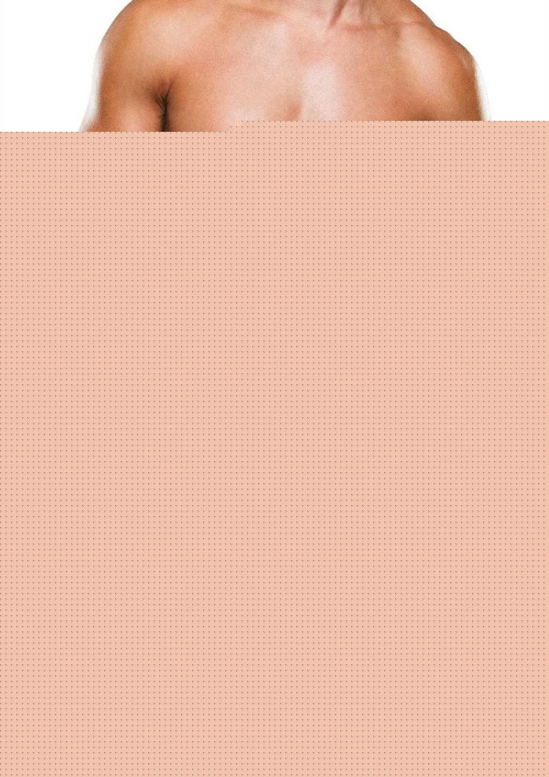 Prowler Fruits Trunk - Yellow - Medium